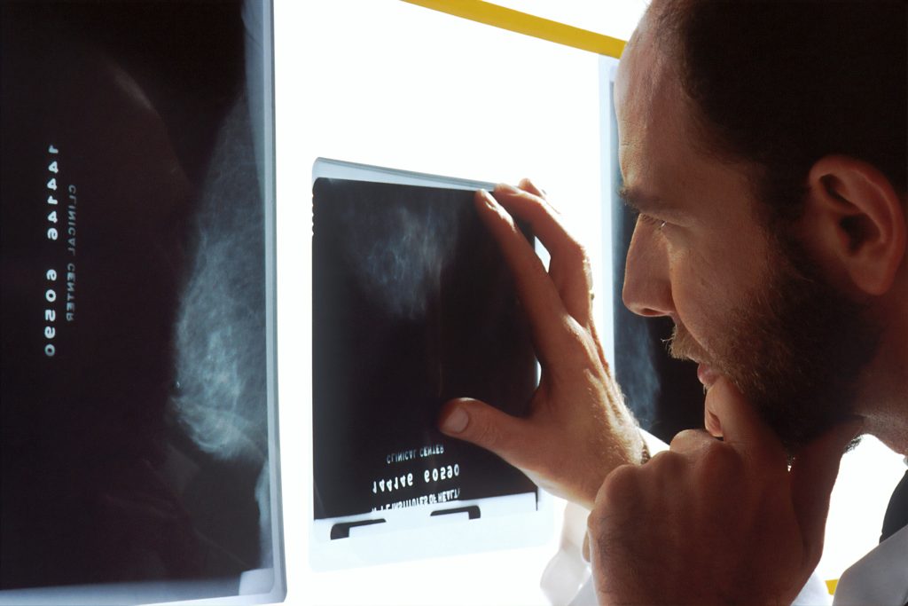 CBD Olja och Cancer - Vad säger forskningen?